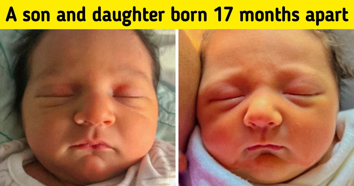 15 Times When Genetics Just Left Us Speechless