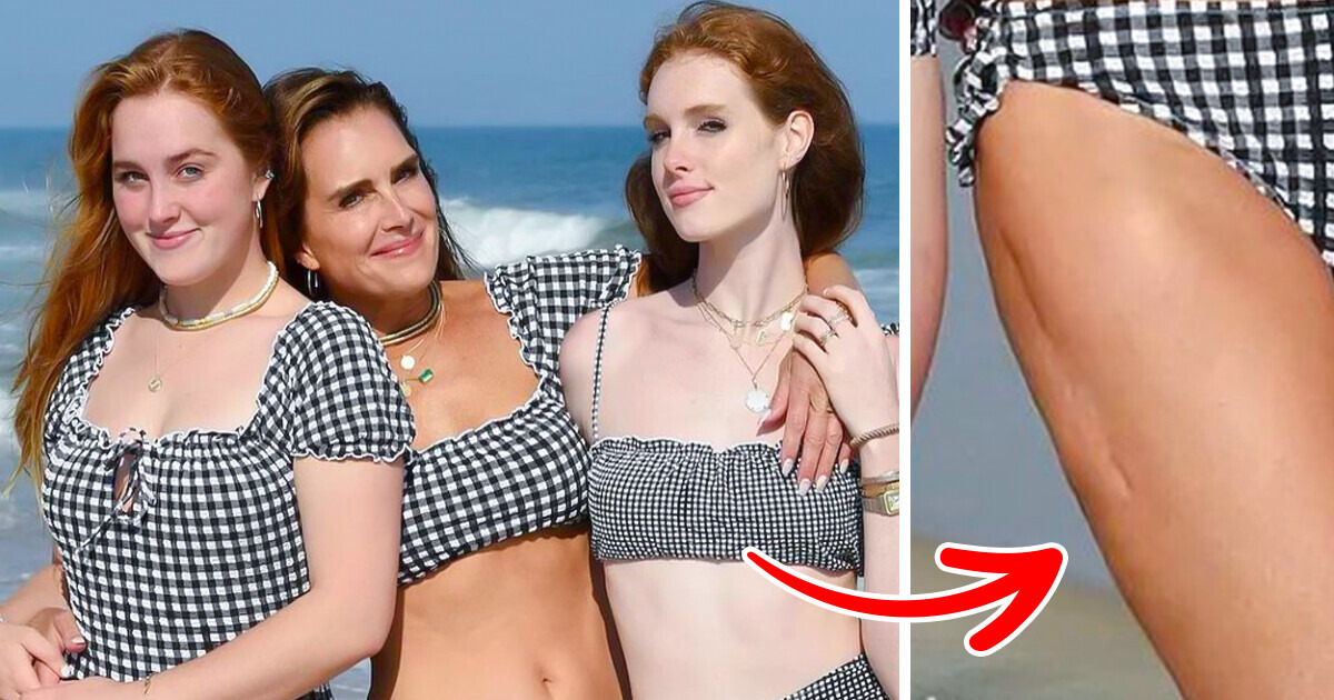 Brooke Shields, 59, Proudly Showed Her Body in a Bikini, and People Spotted a Curious Detail Brooke Shields, 59, Proudly Showed Her Body in a Bikini, and People Spotted a Curious Detail