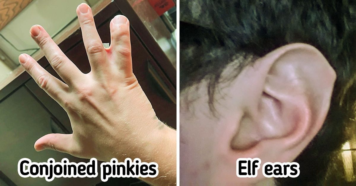 15 People Whose Own Body Will Never Get Tired of Surprising Them 15 People Whose Own Body Will Never Get Tired of Surprising Them