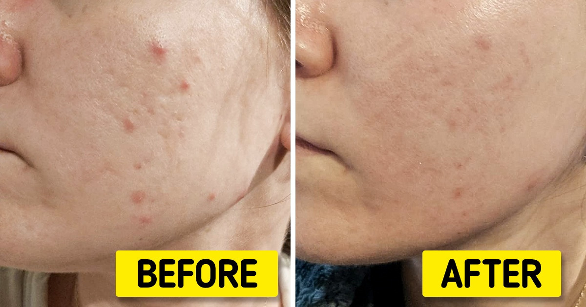 10 Products That’ll All but Guarantee You Healthy Skin 10 Products That’ll All but Guarantee You Healthy Skin