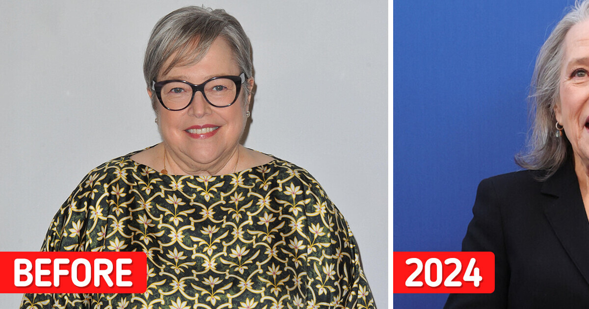 Kathy Bates, 76, Deemed Unrecognizable After Huge Transformation, “You Can’t Lose That Much Weight After a Certain Age” Kathy Bates, 76, Deemed Unrecognizable After Huge Transformation, “You Can’t Lose That Much Weight After a Certain Age”