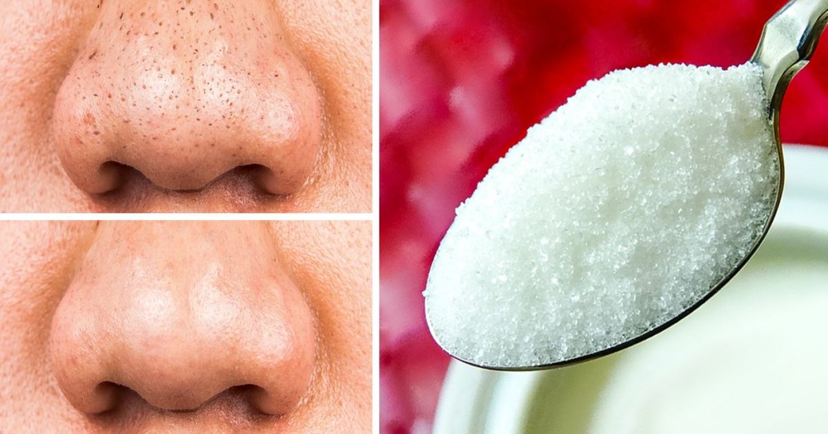 12 Natural Products to Help Your Skin Stay Forever Young