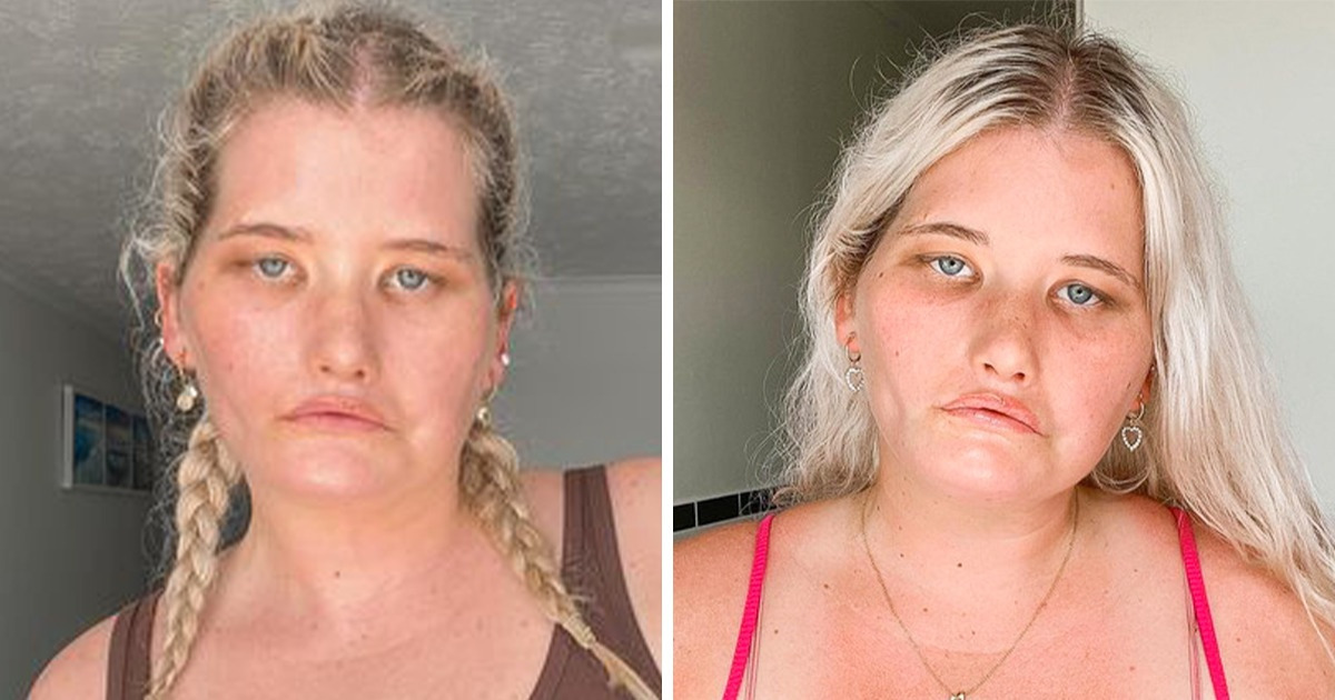 A Girl “Who Can’t Smile” Becomes a Model and Proves Beauty Shines Through in Many Ways