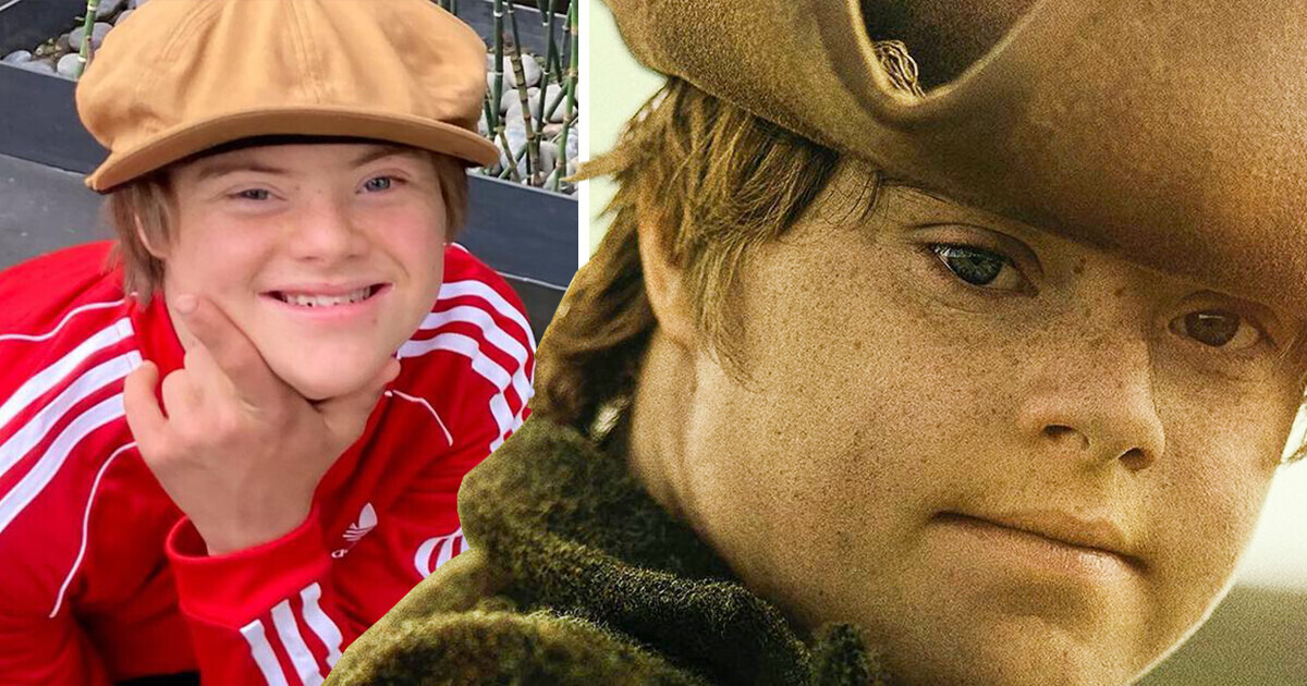 Breaking Barriers: Noah Matthews Makes History as Disney’s First Down Syndrome Star