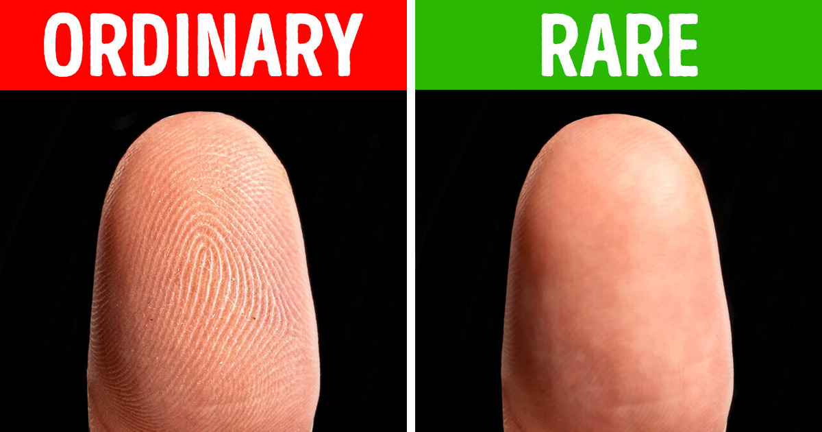 How People Without Fingerprints Live and Travel How People Without Fingerprints Live and Travel