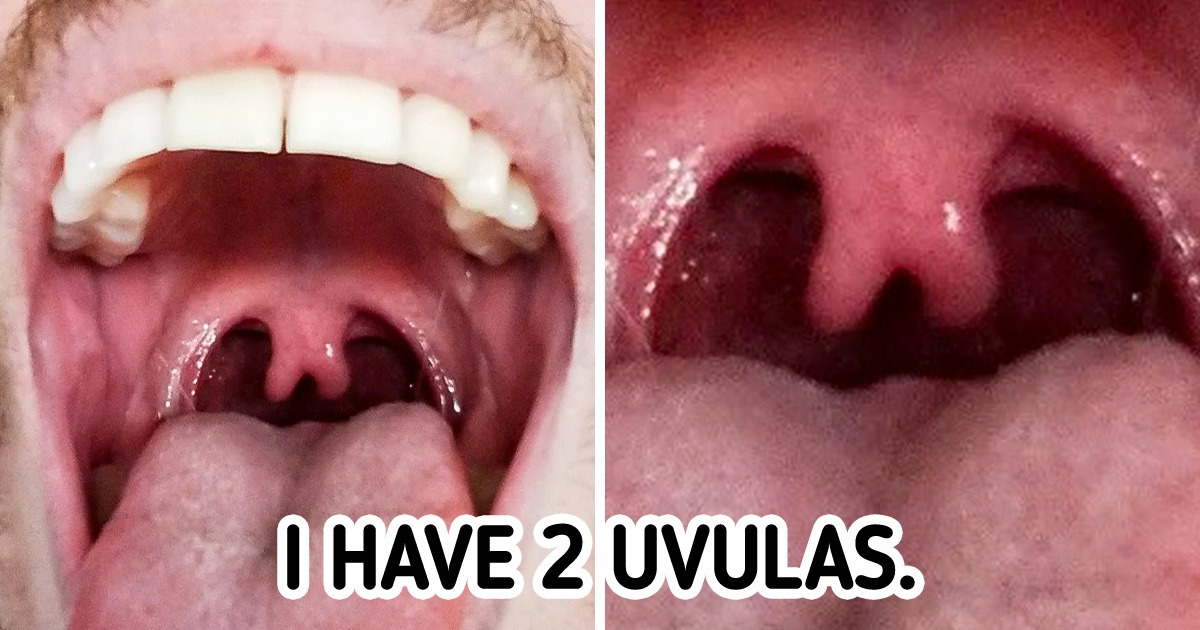 15+ Times When Nature Felt Like Playing the Genetic Lottery