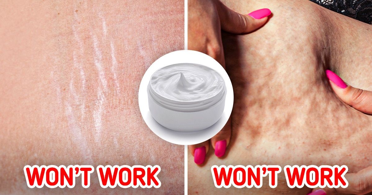 10 Beauty Products Dermatologists Recommend You to Stop Wasting Your Money On