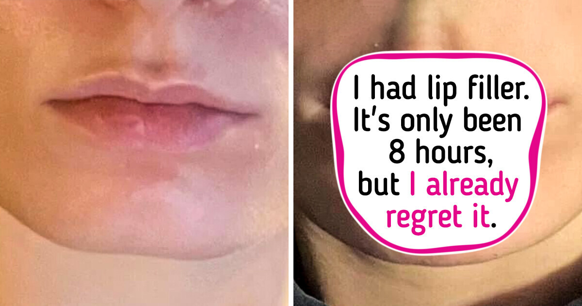 18 Photos About Difference That Are Worth a Thousand Words