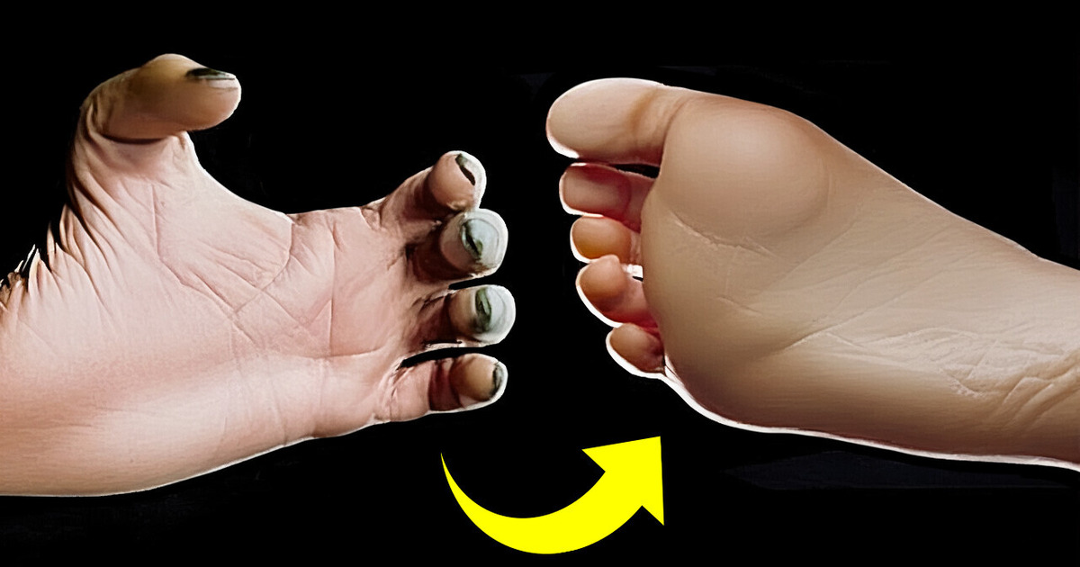 Why We Evolved to Have Such Tender Feet
