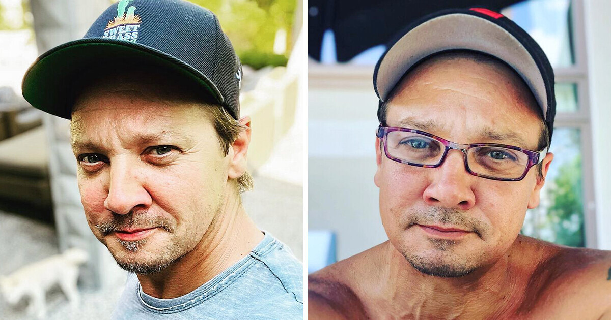What Happened to Jeremy Renner: His Brutal Accident Changed How He Sees Life (As He Still Fights to Fully Recover) What Happened to Jeremy Renner: His Brutal Accident Changed How He Sees Life (As He Still Fights to Fully Recover)