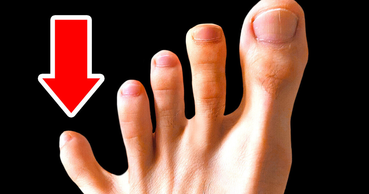 You Don’t Need 5 Toes or 14 Other Body Features