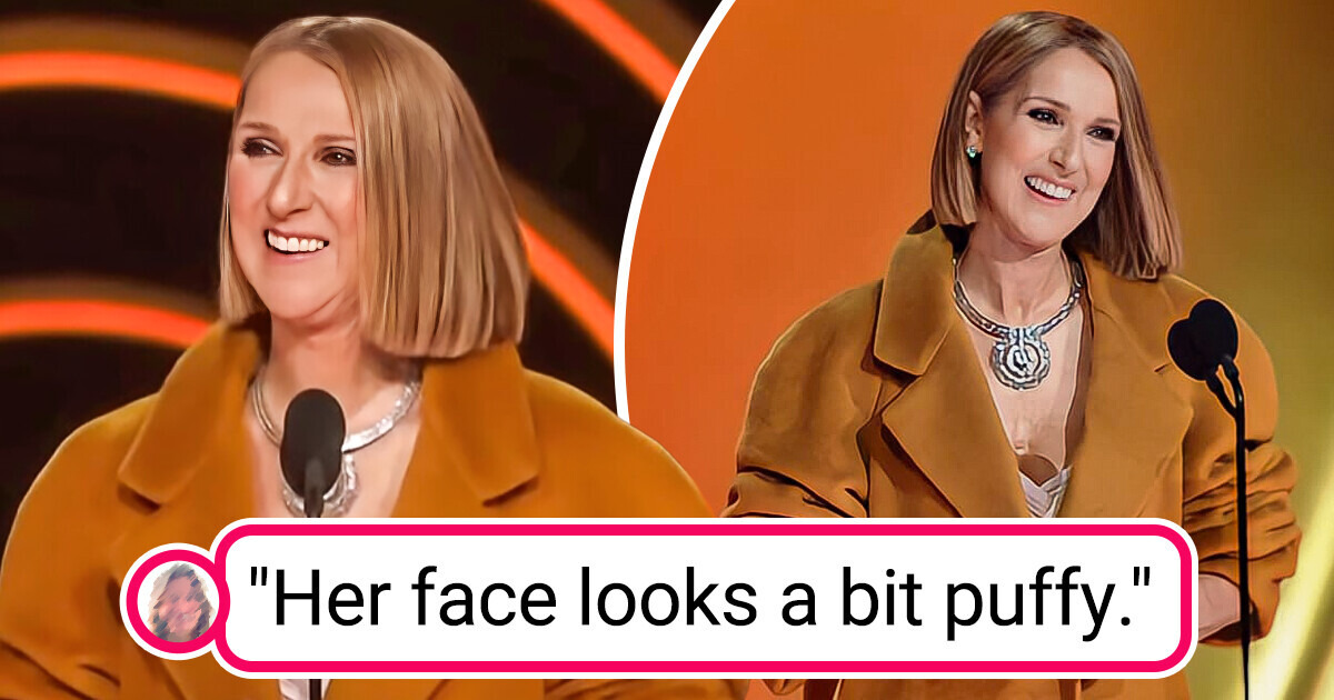 Fans Notice Changes in Céline Dion’s Appearance and Speculate About Her Health