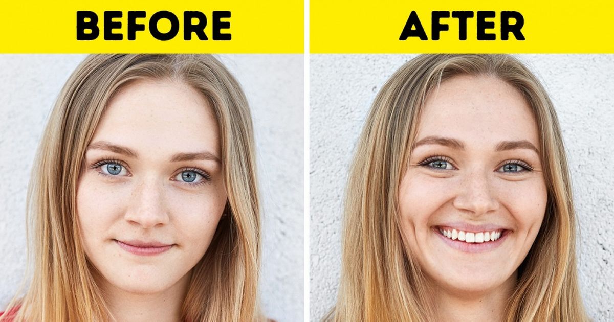 13 Unusual Plastic Surgeries That Are Becoming Popular