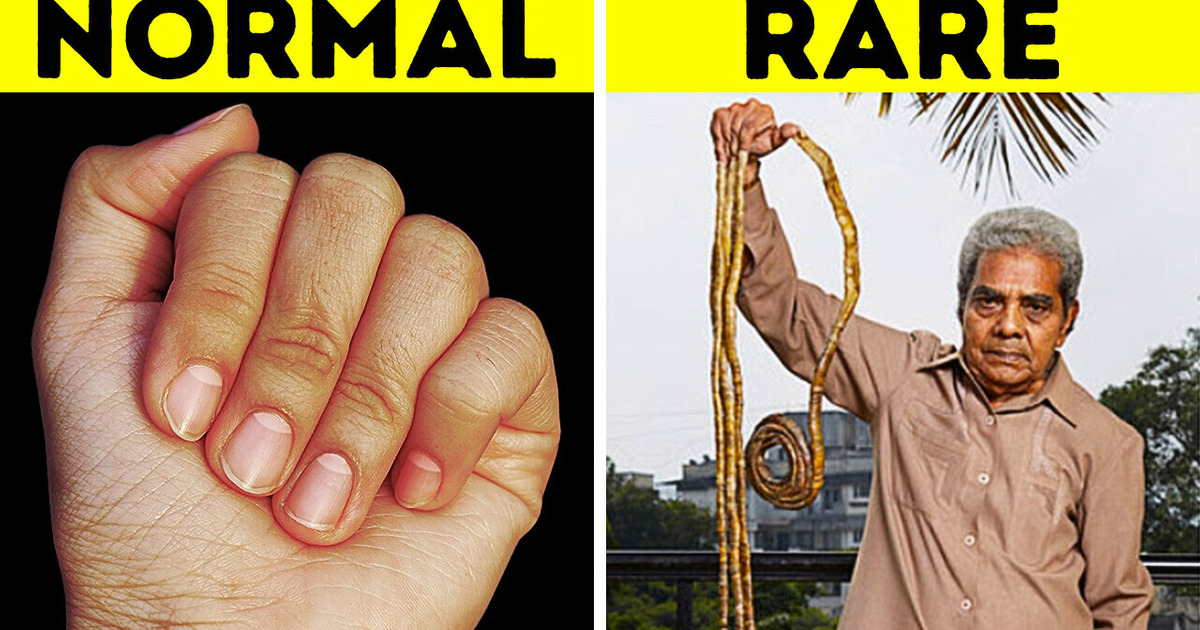 If You Wondered Why Your Body Does That, Now You Know If You Wondered Why Your Body Does That, Now You Know