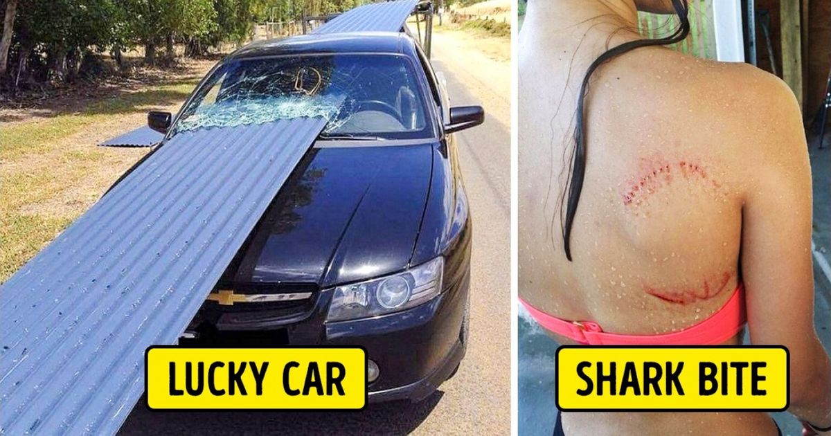 20 People Who Cheated Death and Lived to Tell the Tale 20 People Who Cheated Death and Lived to Tell the Tale