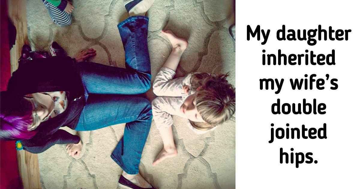 18 Photos That Show What Our Genes Are Capable Of 18 Photos That Show What Our Genes Are Capable Of