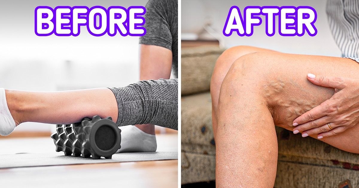 5 Pieces of Home Fitness Equipment That May Do More Harm Than Good