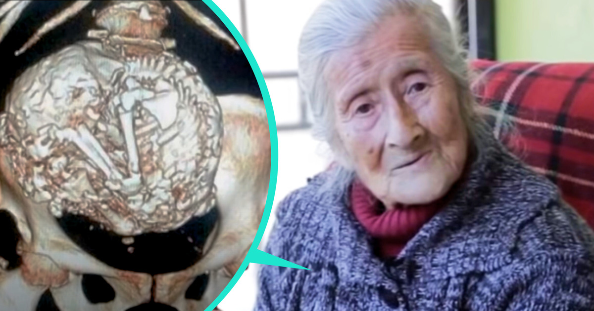 The Story of the Elderly Woman With Malaise That Turned Out to Be a 50-Year-Old Fetus The Story of the Elderly Woman With Malaise That Turned Out to Be a 50-Year-Old Fetus