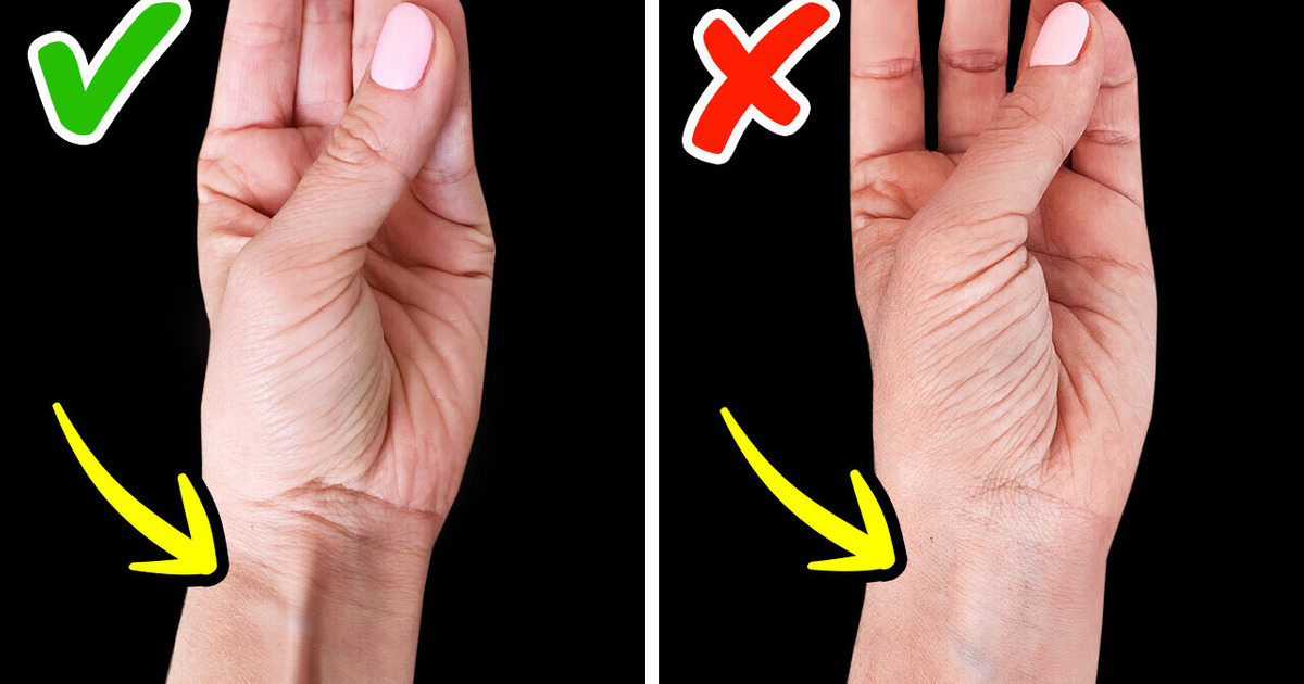 Touch Your Pinky and Thumb, See How Rare You Are Touch Your Pinky and Thumb, See How Rare You Are