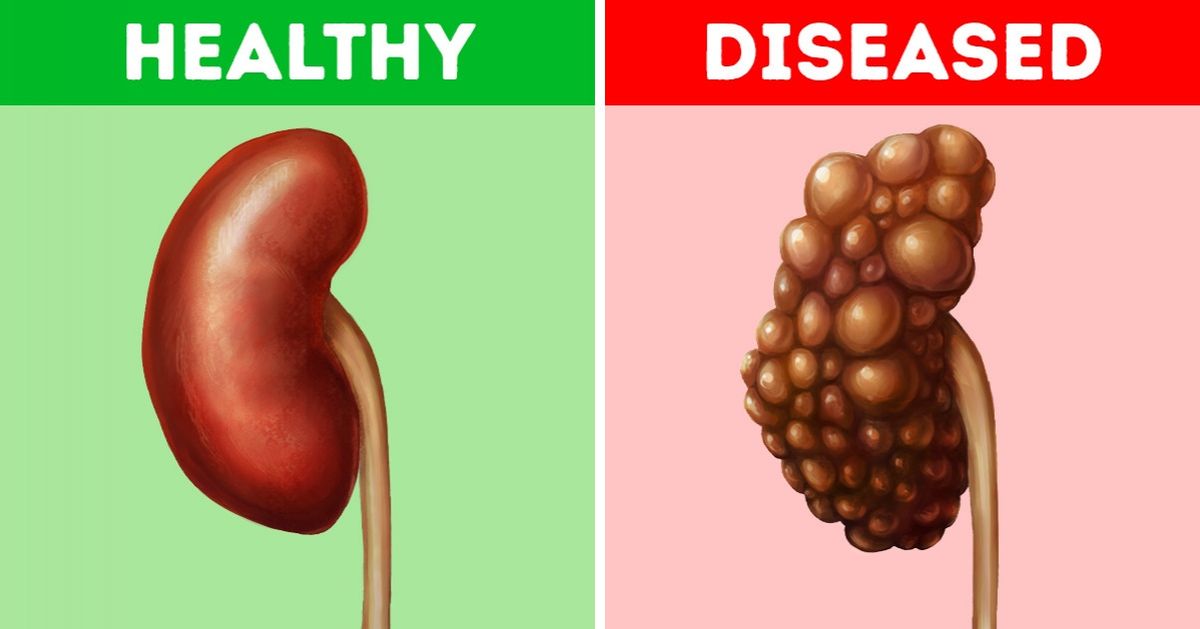 10 Common Habits That Can Damage Your Kidneys 10 Common Habits That Can Damage Your Kidneys
