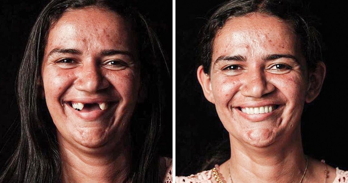 A Brazilian Dentist Travels the World to Return Smiles to the Faces of Poor People for Free A Brazilian Dentist Travels the World to Return Smiles to the Faces of Poor People for Free