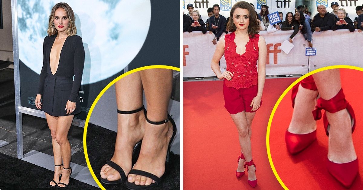 13 Gorgeous Women Who Prove That Miniskirts Aren’t Just for Young Girls