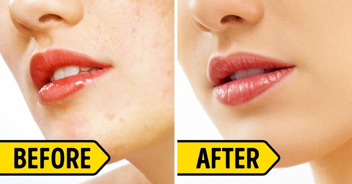 24 Tried and Tested Beauty Tips to Make Your Skin Glow