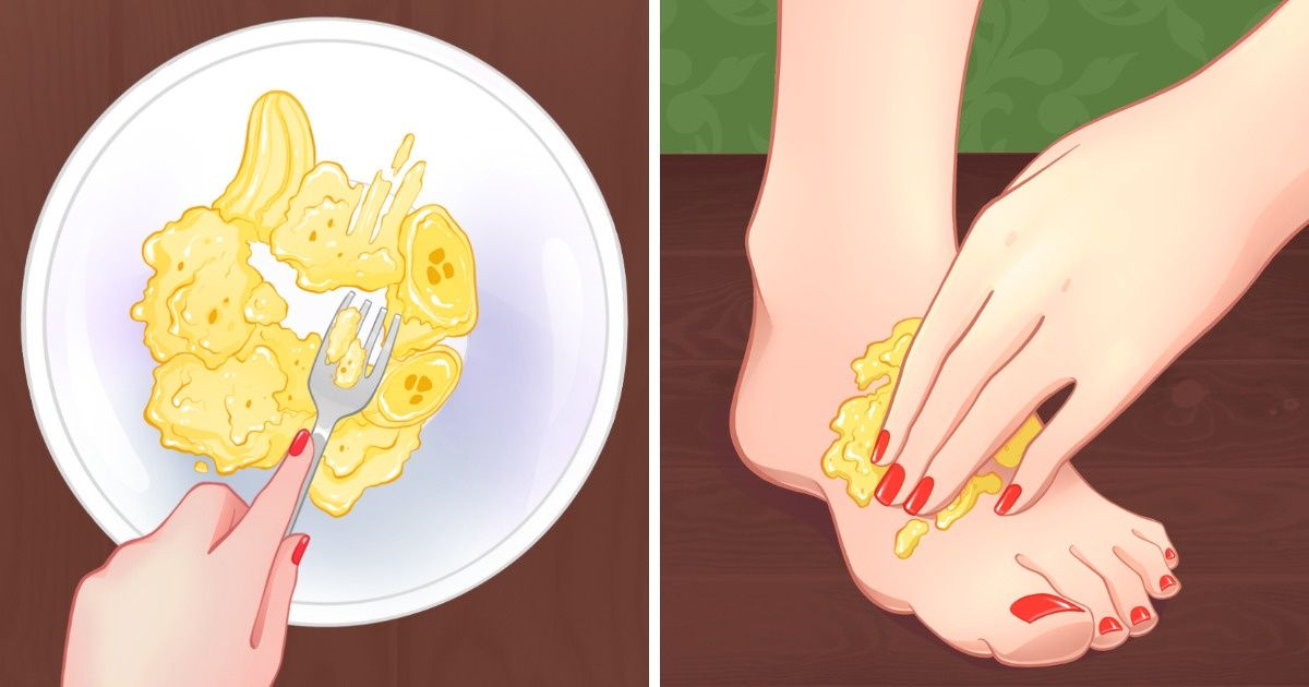 7 Ways to Take Care of Your Feet After They’ve Carried You Around All Day