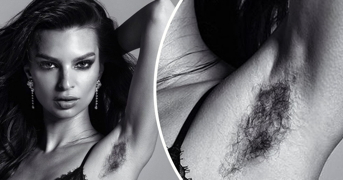15 Famous Women Who Aren’t Bothered by a Bit of Body Hair