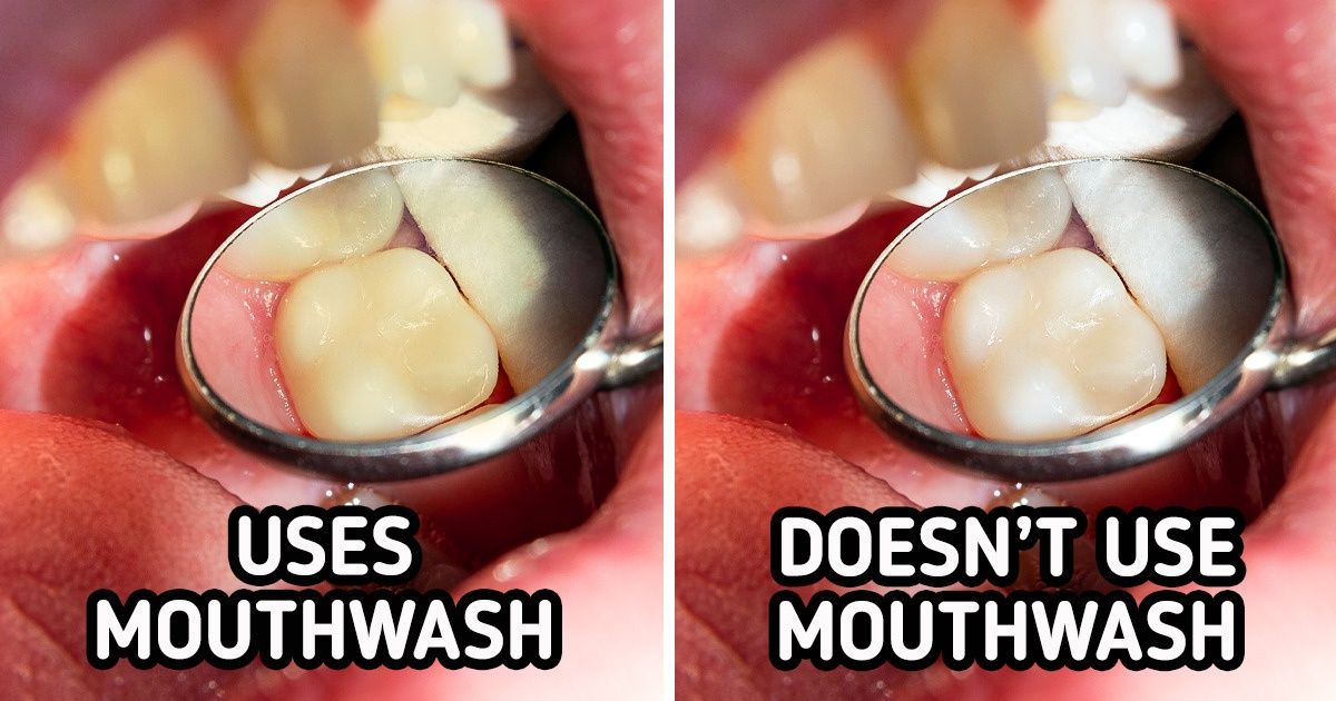 7 Daily Habits That Are Staining Your Teeth 7 Daily Habits That Are Staining Your Teeth