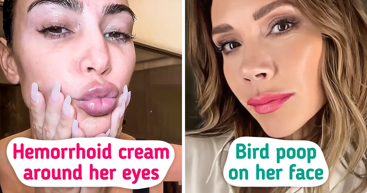 10 Odd Cosmetic Procedures Celebrities Have Done 10 Odd Cosmetic Procedures Celebrities Have Done