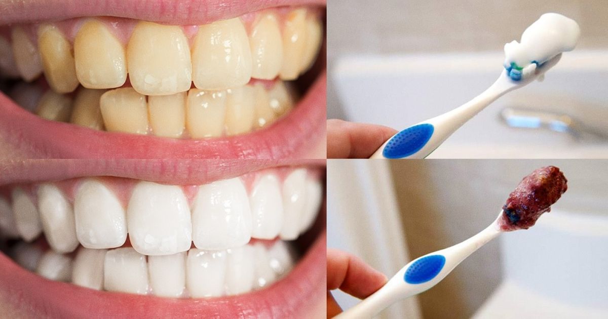 9 Tips for a Perfect Hollywood Smile