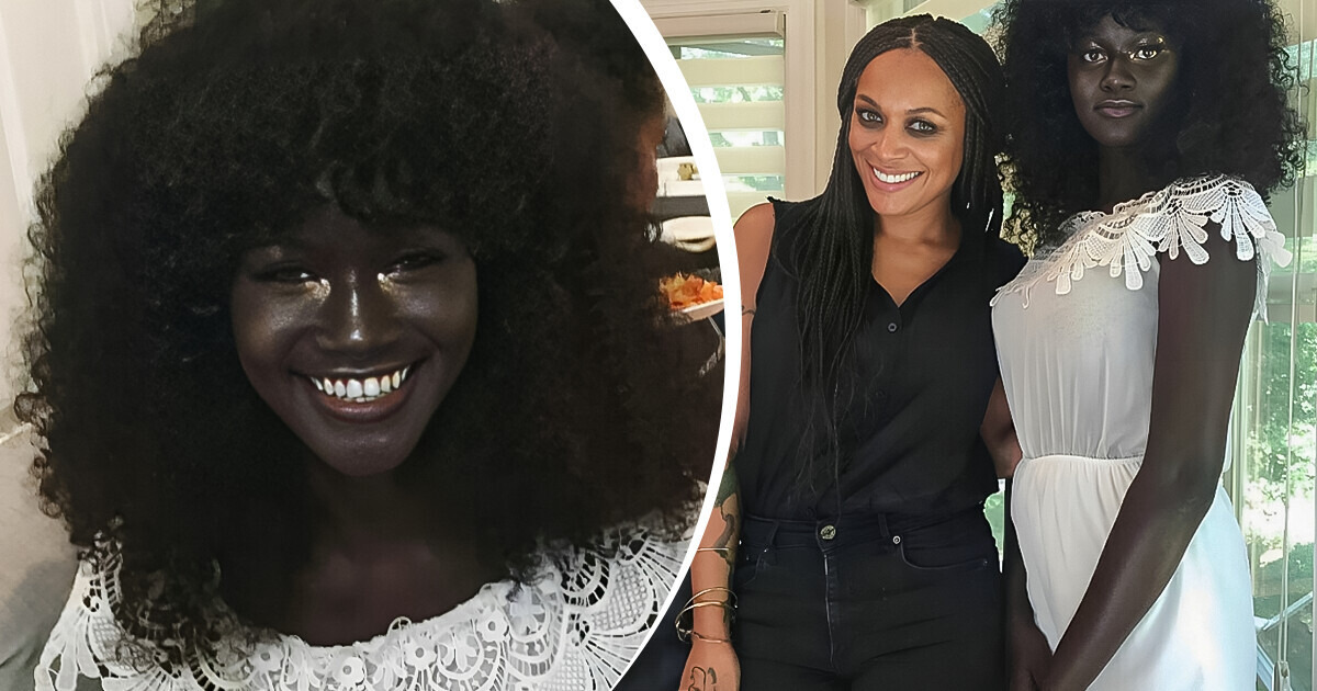 Model Teased for Her Intensely Dark Skin Proves Beauty Comes in Every Shade Model Teased for Her Intensely Dark Skin Proves Beauty Comes in Every Shade