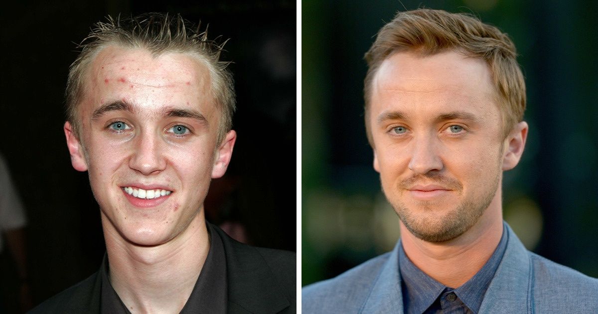 20 Famous Men Who Went From Cubs to Kings