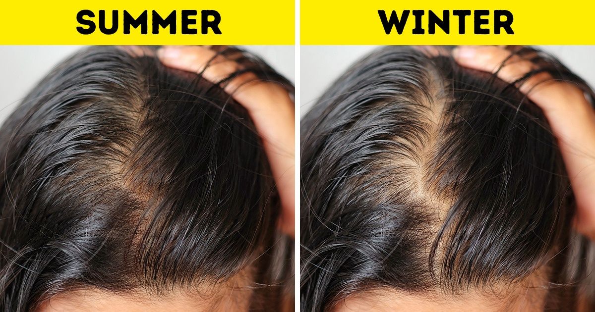 6 Things That Can Happen to Your Hair in Winter, and How to Fix Them
