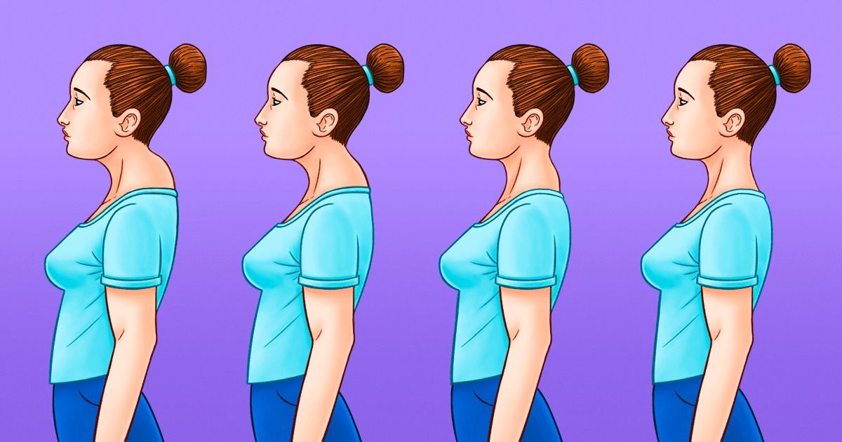 BETTER POSTURE: HOW TO GET RID OF A Dowager's Hump