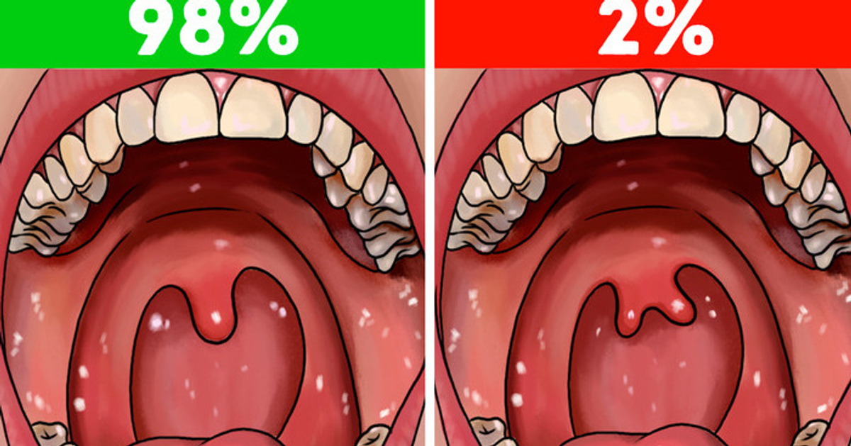 12 Rarest Body Features Could Set You Apart