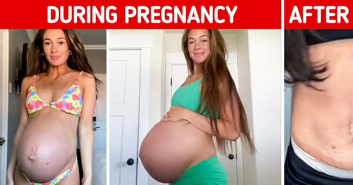 This Mom’s Bump Is Raising Eyebrows, Trolls Think It’s a Fake Watermelon This Mom’s Bump Is Raising Eyebrows, Trolls Think It’s a Fake Watermelon