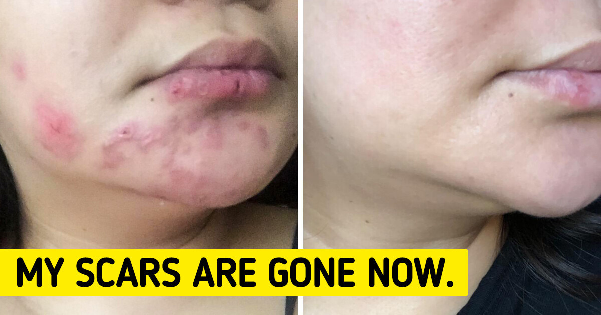 Pics don’t lie: These 10 beauty gems from Amazon work so well, you’ll think it’s witchcraft Pics don’t lie: These 10 beauty gems from Amazon work so well, you’ll think it’s witchcraft