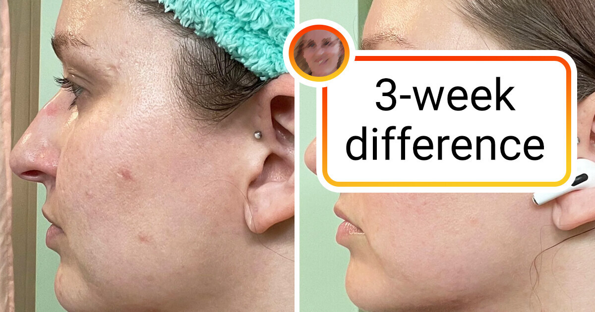 10 Women Who Started Discovering Skin Care and Now Can’t Stop Radiating Joy