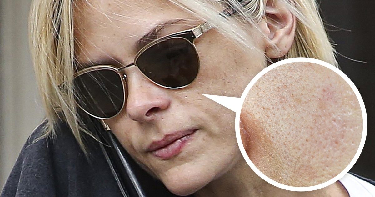 7 Daily Habits That Are Likely Clogging Your Pores