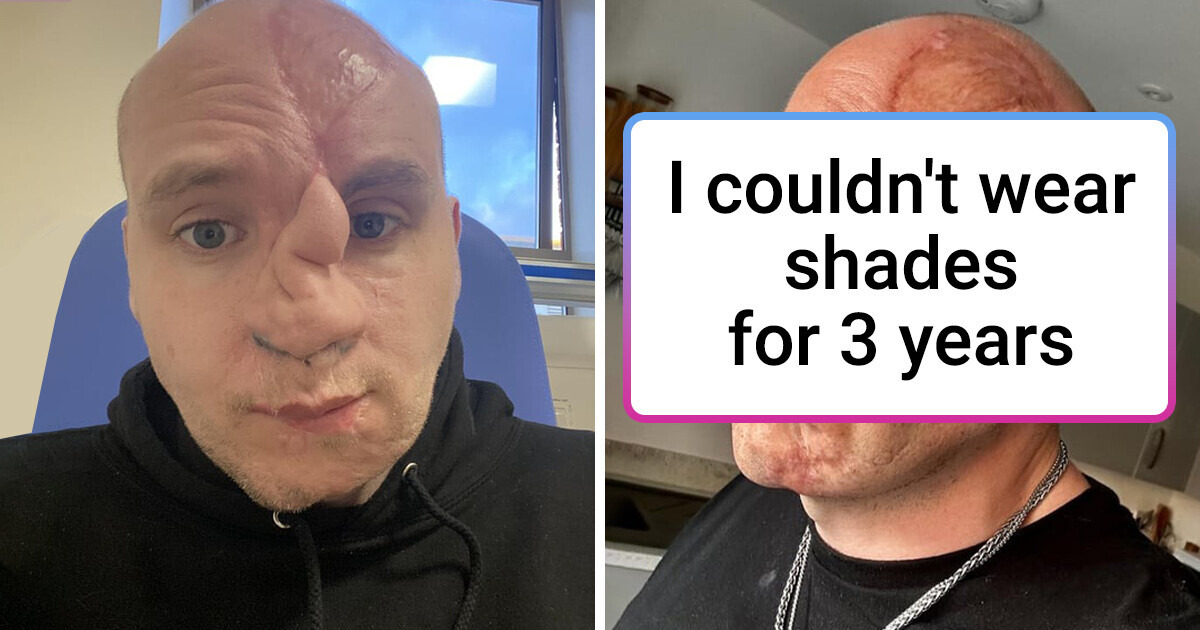 18 Transformations That Prove Surgeons Are Literally Magicians 18 Transformations That Prove Surgeons Are Literally Magicians