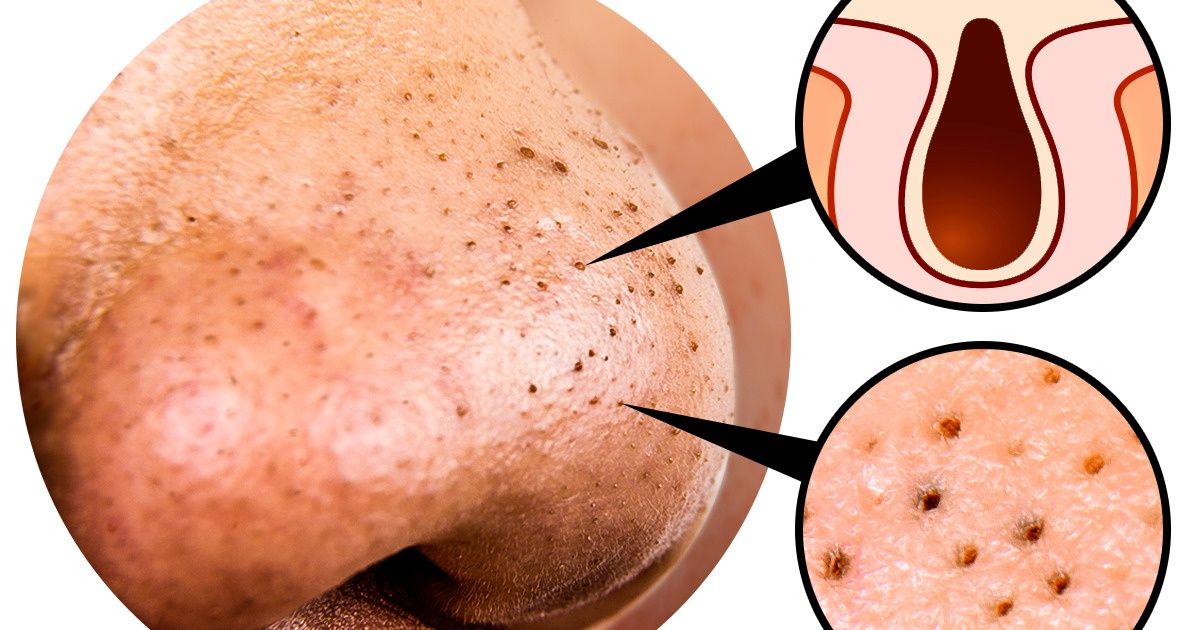 10 Steps of Korean Skin Care Routine That Can Make You Look 15 Years Younger