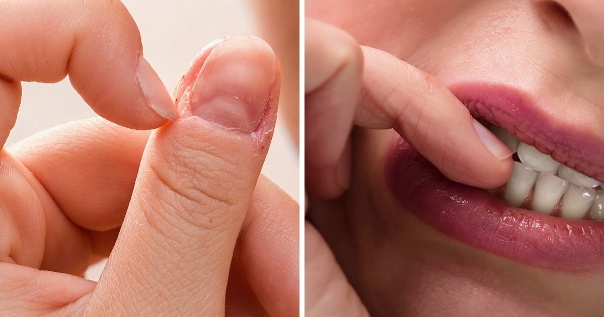 Is biting nails a psychological problem or a biological reaction? - Quora