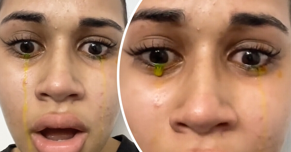 A Woman Shares a Video of Her Crying Yellow: Here’s Why It Happens ...