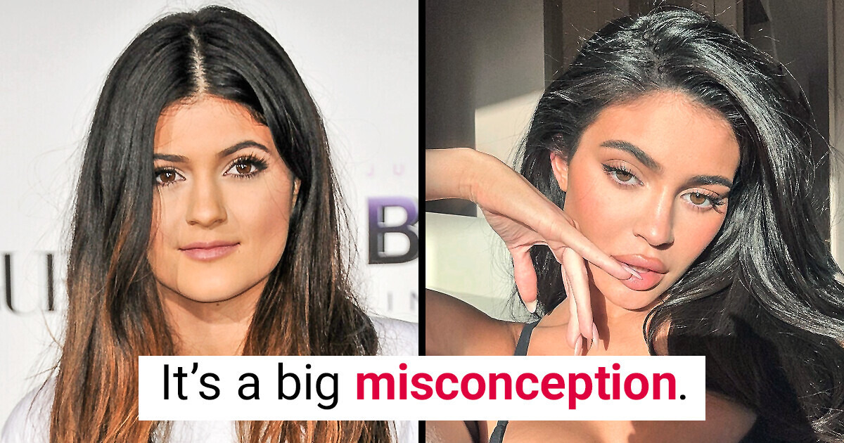 Kylie Jenner Shuts Down Rumors That She’s Had Too Much Surgery on Her ...