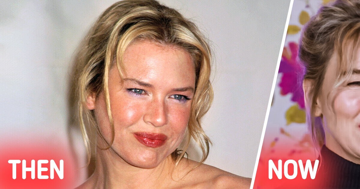 Renée Zellweger’s Transformative New Look Sparks Curiosity Among Fans Renée Zellweger’s Transformative New Look Sparks Curiosity Among Fans