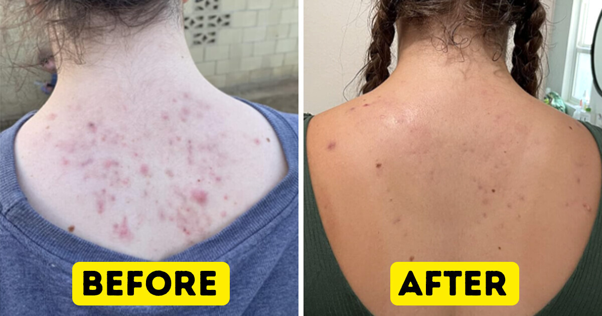 14 products that will solve the most common beauty issues