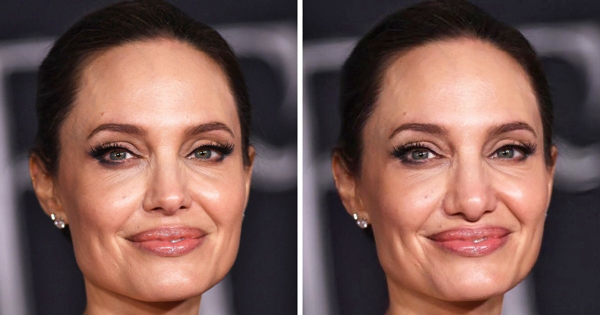 celebrities without noses
