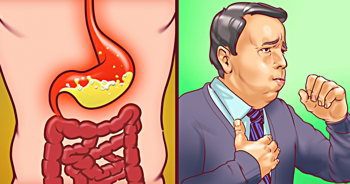 6 Signs You’re Suffering From Acid Reflux and How to Fix It 6 Signs You’re Suffering From Acid Reflux and How to Fix It